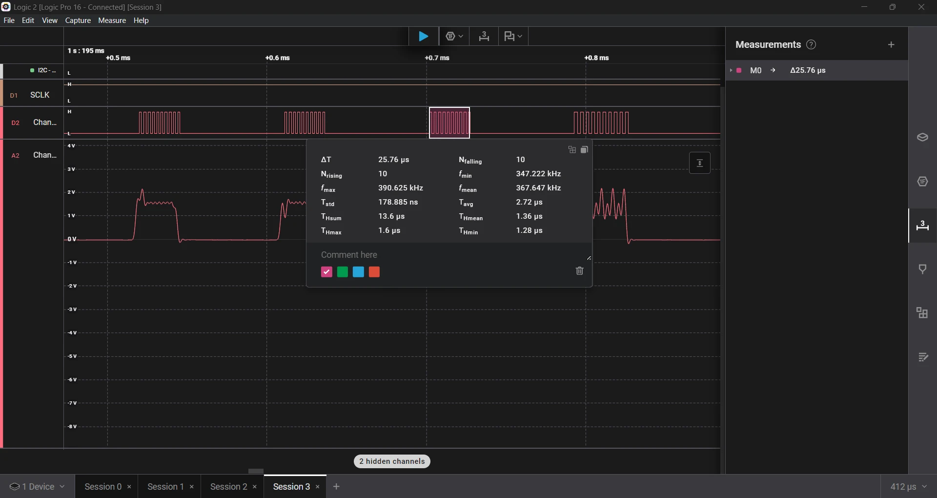 Logic analyzer view of bad TIM2 config measurement